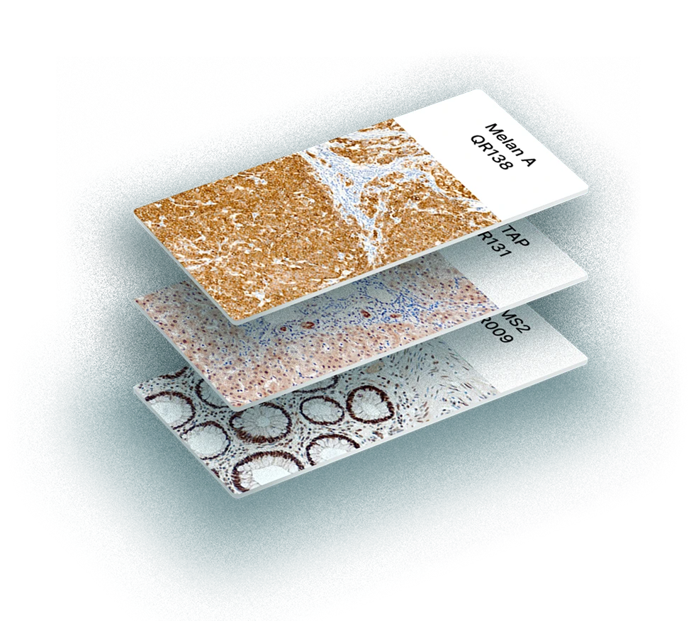 Redefining cancer diagnostics